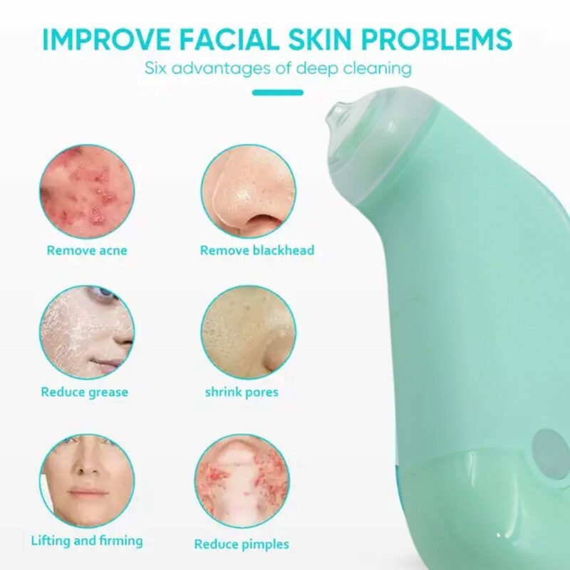 03_eead7a96-8bb7-47f9-8989-79a17bbaf6de.jpg Vacuum Blackhead Remover – Mini Handheld Facial Tool | GlowForm
