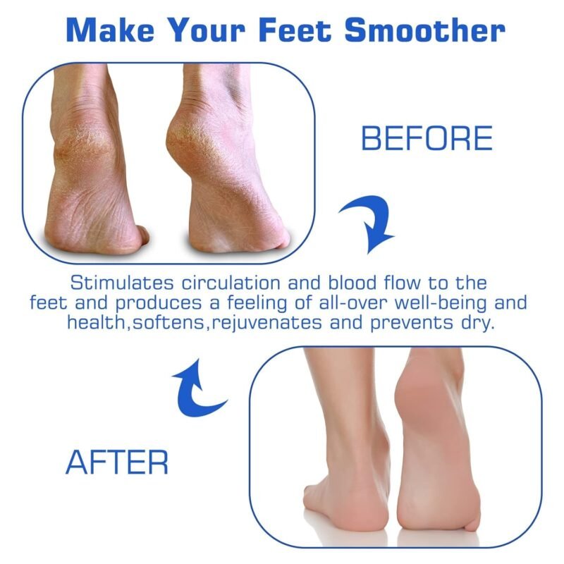 Silicone Foot Scrubber Mat � Soft Bristles for Easy Foot Care