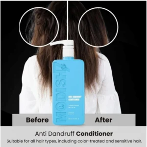Generic Unisex Protein Anti Dandruff Conditioner (350 ML)