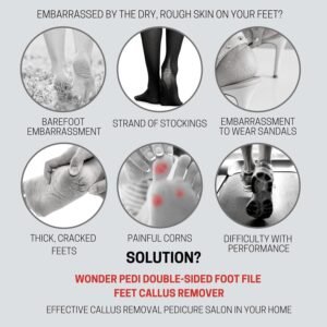 PedicureFootFileCallusRemover-02.jpg Dual Sided Foot File – Effective Dead Skin Removal & Smoothing